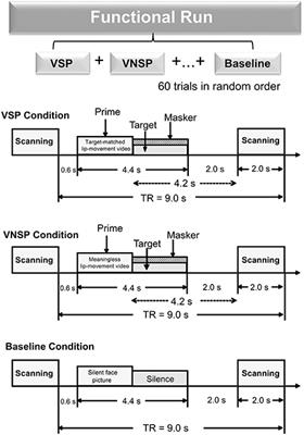 Activation and Functional Connectivity of the Left Inferior Temporal Gyrus during Visual Speech Priming in Healthy Listeners and Listeners with Schizophrenia